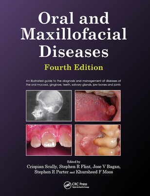 Oral and Maxillofacial Diseases, Fourth Edition Cover Image