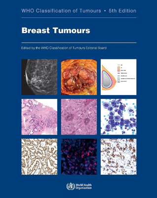 Breast Tumours: Who Classification of Tumours Cover Image