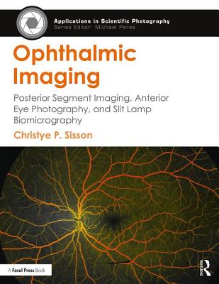 Ophthalmic Imaging: Posterior Segment Imaging, Anterior Eye Photography, and Slit Lamp Biomicrography (Applications in Scientific Photography)