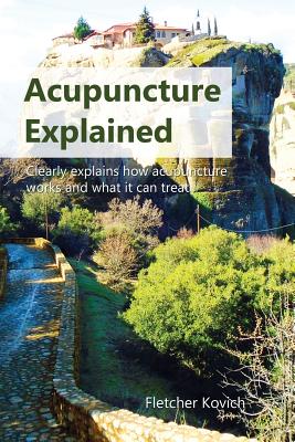 Acupuncture Explained: Clearly explains how acupuncture works and what it can treat Cover Image