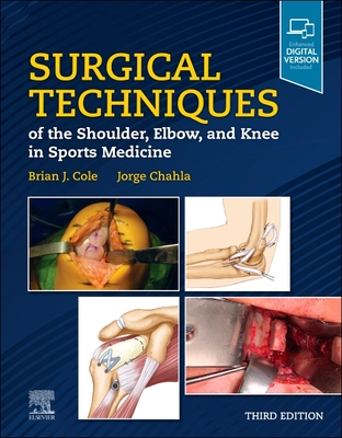 Surgical Techniques of the Shoulder, Elbow, and Knee in Sports Medicine By Brian J. Cole (Editor), Jorge Chahla (Editor) Cover Image