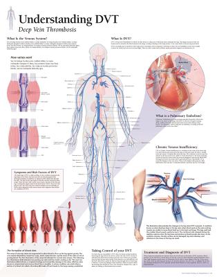 Understanding Dvt Chart: Laminated Wall Chart Cover Image