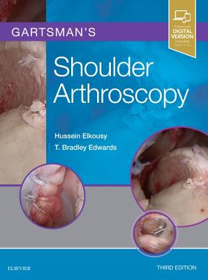Gartsman's Shoulder Arthroscopy Cover Image