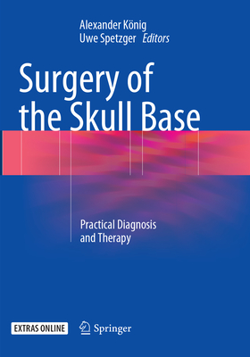 Surgery of the Skull Base: Practical Diagnosis and Therapy By Alexander König (Editor), Uwe Spetzger (Editor) Cover Image
