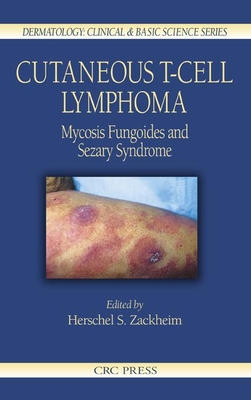 Cutaneous T-Cell Lymphoma: Mycosis Fungoides and Sezary Syndrome (Dermatology: Clinical & Basic Science #26)