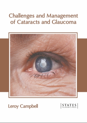 Challenges and Management of Cataracts and Glaucoma Cover Image