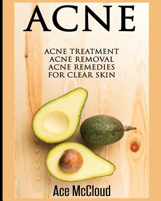 Acne: Acne Treatment: Acne Removal: Acne Remedies For Clear Skin Cover Image