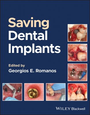 Saving Dental Implants Cover Image