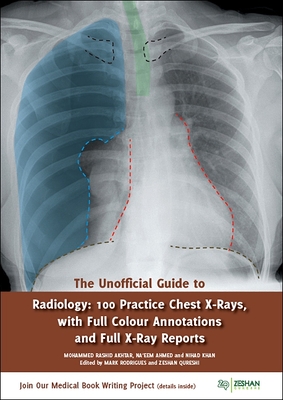 The Unofficial Guide to Radiology: 100 Practice Chest X Rays with Full Colour Annotations and Full X Ray Reports (Unofficial Guides)
