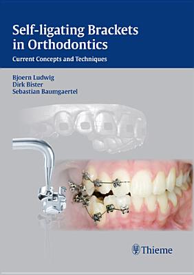 Self-Ligating Brackets in Orthodontics: Current Concepts and Techniques Cover Image