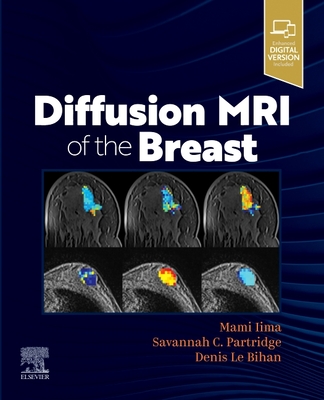 Diffusion MRI of the Breast By Mami Iima (Editor), Savannah Partridge (Editor), Denis Le Bihan (Editor) Cover Image