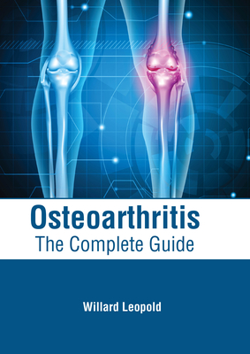 Osteoarthritis: The Complete Guide Cover Image