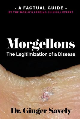 Morgellons: The legitimization of a disease: A Factual Guide by the World's Leading Clinical Expert Cover Image