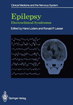Epilepsy: Electroclinical Syndromes (Clinical Medicine and the Nervous System)