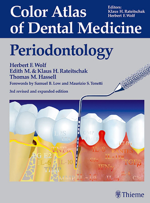 Periodontology (Color Atlas Dent Med) By Thomas M. Hassell (Editor) Cover Image