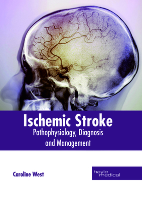 Ischemic Stroke: Pathophysiology, Diagnosis and Management Cover Image