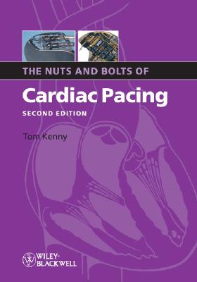 Nuts Bolts Cardiac Pacing 2e (Nuts and Bolts Series (Replaced by 5113) #1) Cover Image