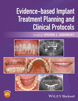 Evidence-Based Implant Treatment Planning and Clinical Protocols By Steven J. Sadowsky (Editor) Cover Image