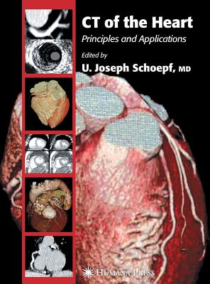 CT of the Heart: Principles and Applications (Contemporary Cardiology) Cover Image