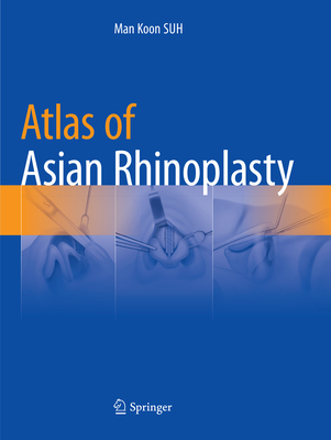 Atlas of Asian Rhinoplasty: 9789811342042: Medicine & Health