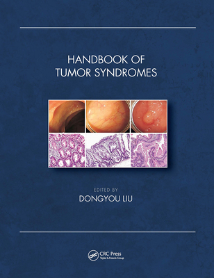 Handbook of Tumor Syndromes By Dongyou Liu (Editor) Cover Image