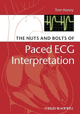 The Nuts and Bolts of Paced ECG Interpretation (Nuts and Bolts Series (Replaced by 5113) #4) Cover Image