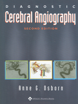 Diagnostic Cerebral Angiography By Anne G. Osborn, MD Cover Image