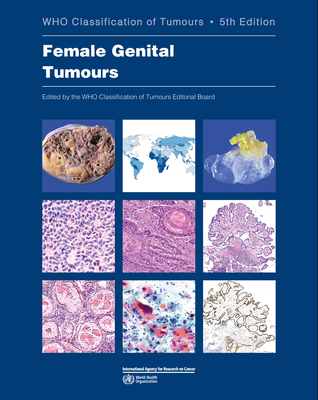 Female Genital Tumours: Who Classification of Tumours Cover Image
