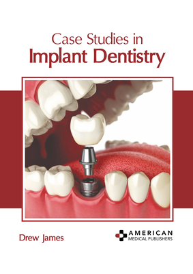 Case Studies in Implant Dentistry By Drew James (Editor) Cover Image