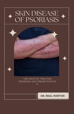 Skin Disease of Psoriasis: The Ways of Treating Psoriasis and Prevention of It Cover Image