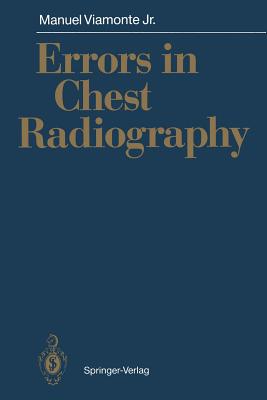 Errors in Chest Radiography Cover Image