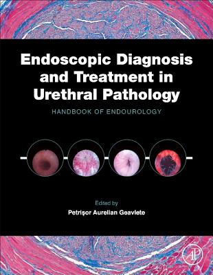 Endoscopic Diagnosis and Treatment in Urethral Pathology: Handbook of Endourology Cover Image