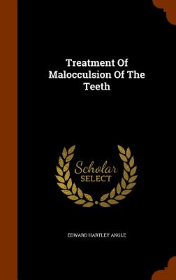 Treatment of Malocculsion of the Teeth Cover Image