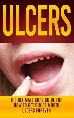 Ulcers: The Ultimate Cure Guide for How to Get Rid of Mouth Ulcers Instantly By Wade Migan Cover Image