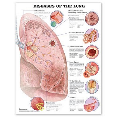 Diseases of the Lung Anatomical Chart Cover Image