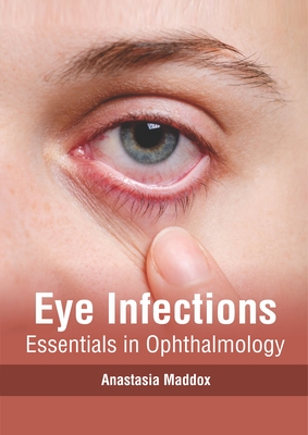 Eye Infections: Essentials in Ophthalmology Cover Image