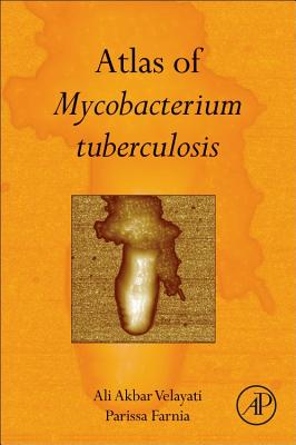 Atlas of Mycobacterium Tuberculosis (Hardcover) | Hooked