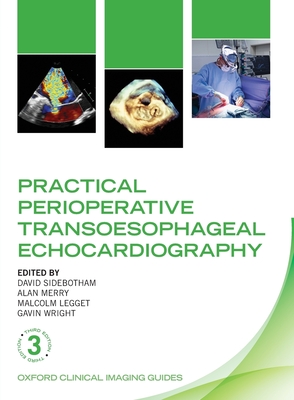 Practical Perioperative Transoesophageal Echocardiography Cover Image