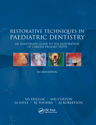 Restorative Techniques in Paediatric Dentistry: An Illustrated Guide to the Restoration of Extensive Carious Primary Teeth Cover Image