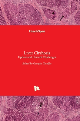 Liver Cirrhosis: Update and Current Challenges Cover Image