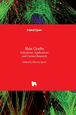 Skin Grafts: Indications, Applications and Current Research Cover Image