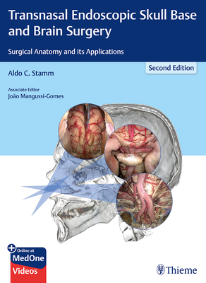 Transnasal Endoscopic Skull Base and Brain Surgery: Surgical Anatomy and Its Applications Cover Image