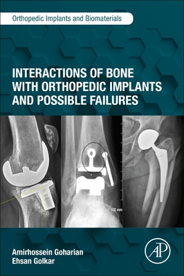 Interactions of Bone with Orthopedic Implants and Possible Failures By Amirhossein Goharian, Ehsan Golkar Cover Image