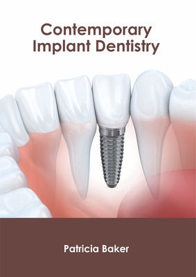 Contemporary Implant Dentistry By Patricia Baker (Editor) Cover Image
