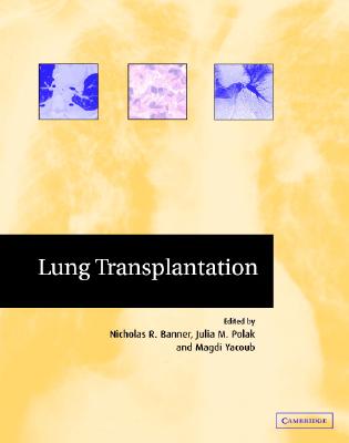 Lung Transplantation (Postgraduate Medical Science S) Cover Image
