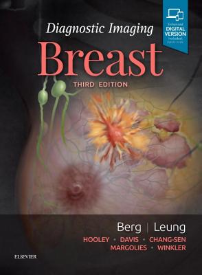 Diagnostic Imaging: Breast Cover Image
