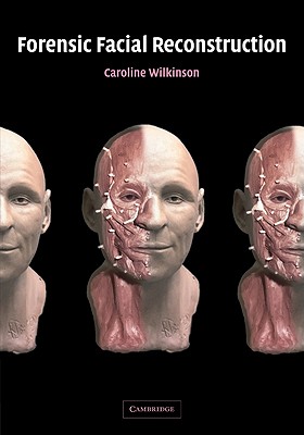 Forensic Facial Reconstruction By Caroline Wilkinson Cover Image