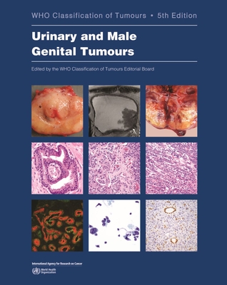 Urinary and Male Genital Tumours (WHO Classification of Tumours #8) By Who Classification of Tumours Editorial (Editor) Cover Image