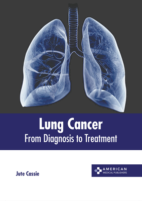 Lung Cancer: From Diagnosis to Treatment Cover Image