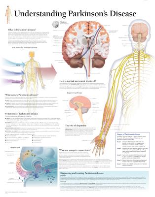 Understanding Parkinson's Chart: Laminated Wall Chart Cover Image